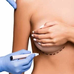 Médecin dessinant une ligne d'incision sur le menu d'augmentation mammaire du patient