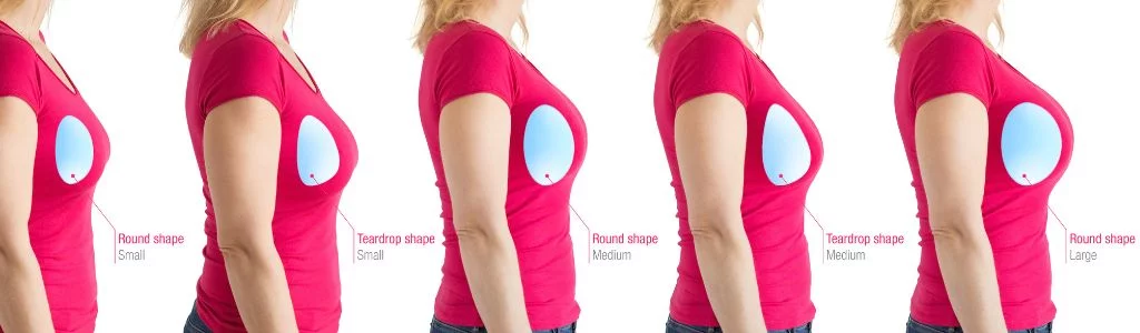 Implants mammaires ronds ou en forme de larme-1